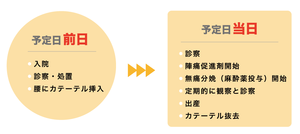 無痛分娩について